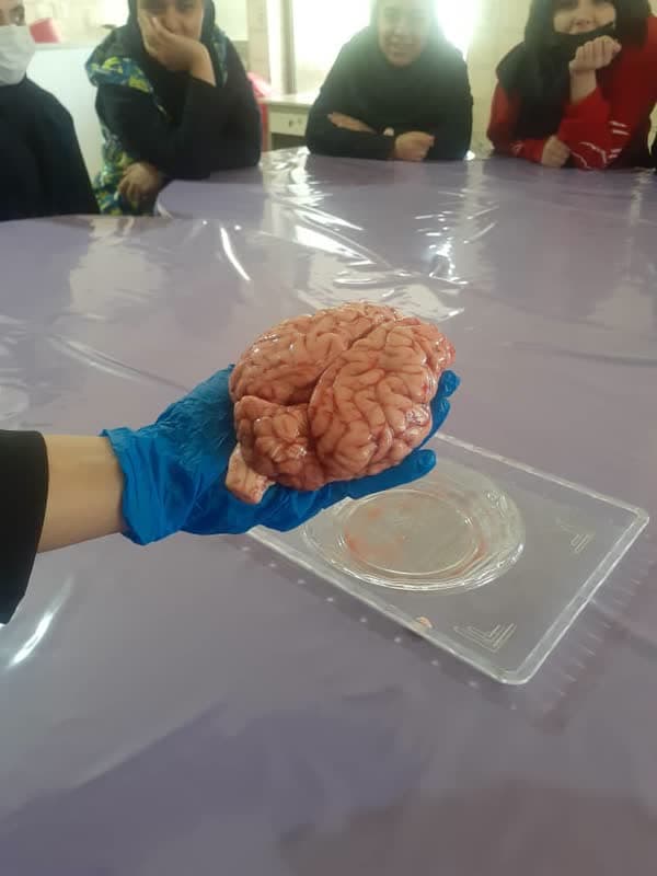 jتشریح مغز توسط دانش آموزان